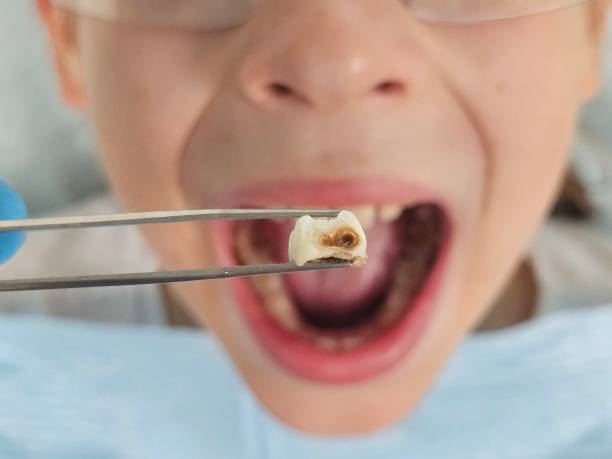 Best Tooth Infection Emergency Dentist  in Hobart, WI